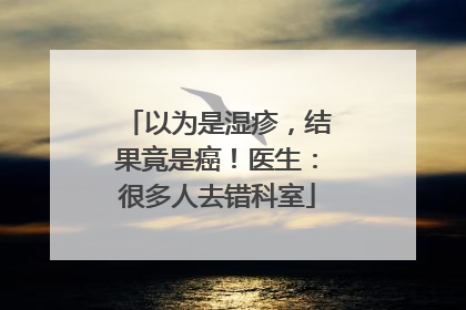 以为是湿疹，结果竟是癌！医生：很多人去错科室